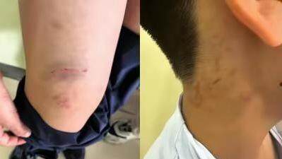 10岁男孩疑遭培训机构老师扇耳光，天津当地：已成立处置专班